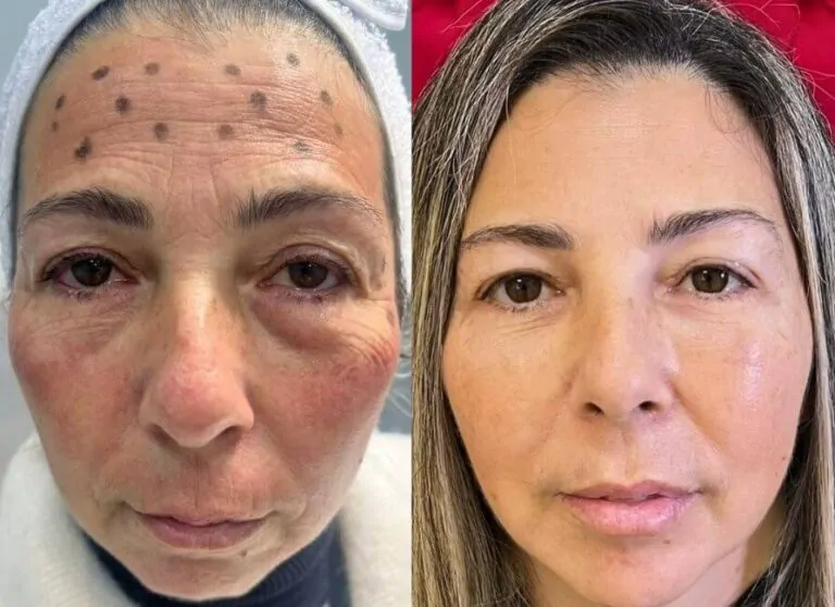 Pacientes satisfeitos que alcançaram resultados