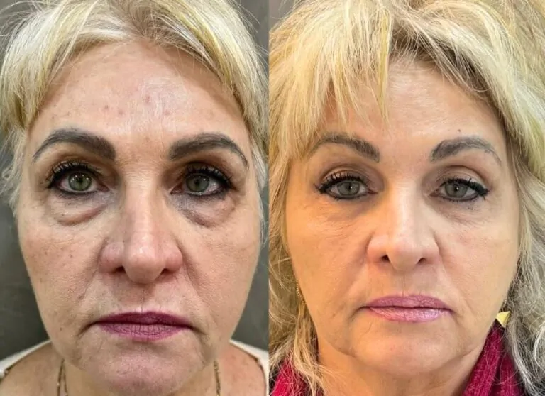 Pacientes satisfeitos que alcançaram resultados