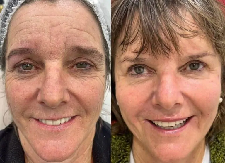 Pacientes satisfeitos que alcançaram resultados