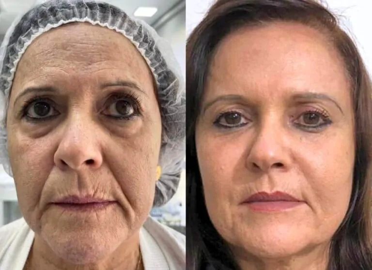 Pacientes satisfeitos que alcançaram resultados